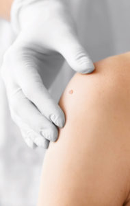 a dermatologist performing a mole check